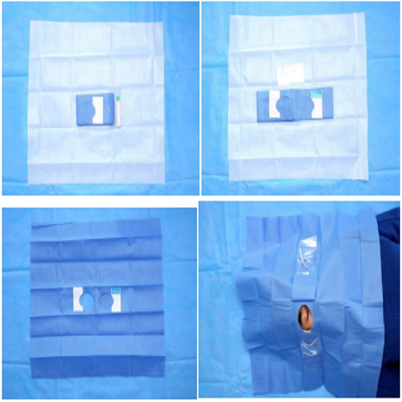 Disposable Excimer Laser Surgery Pack